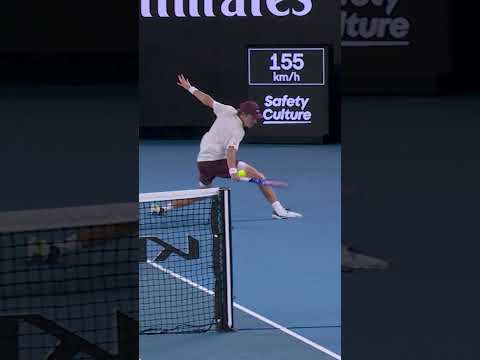 AROUND-the-net winner! 😱